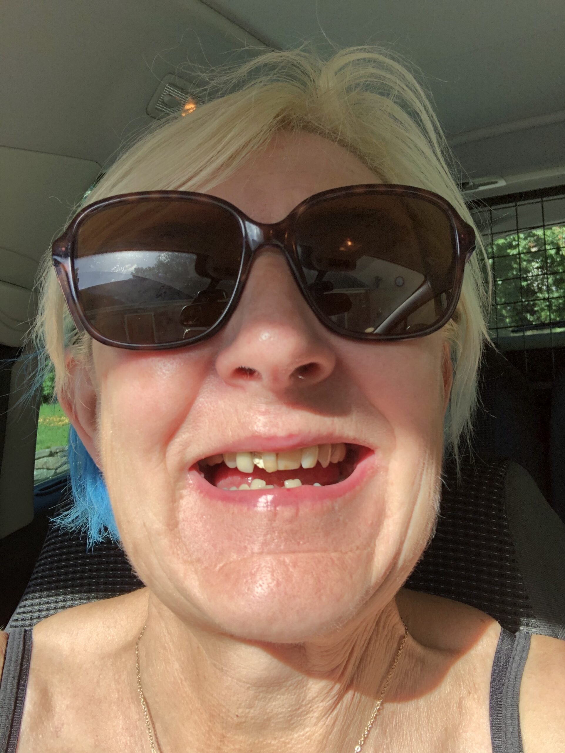 alt="my face with sunglasses on"